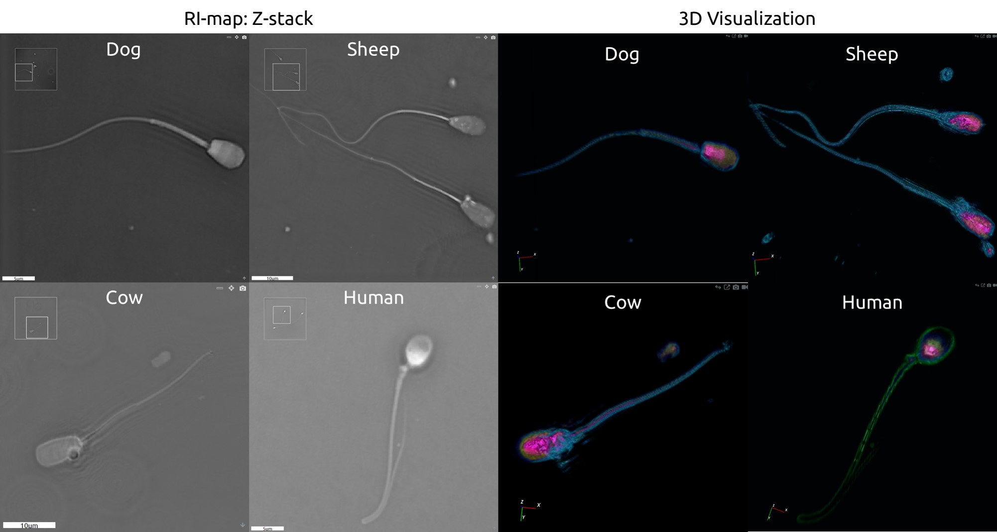 Sperm Cell Comparison